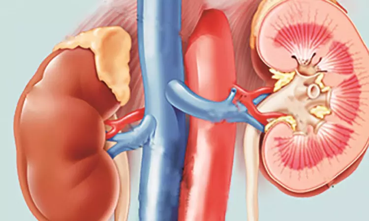 Need to educate people on kidney damage due to antibiotic misuse: Nephrologists Need to educate people on kidney damage due to antibiotic misuse: Nephrologists