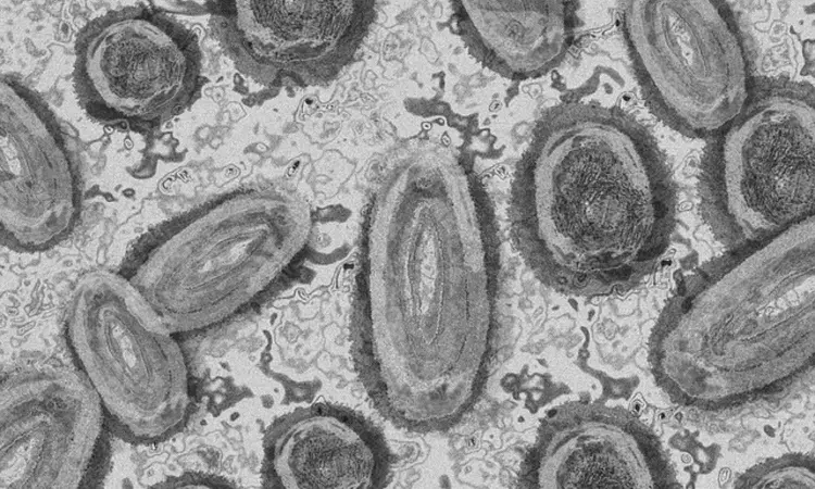 Study decodes how mpox virus infiltrates brain cells Study decodes how mpox virus infiltrates brain cells