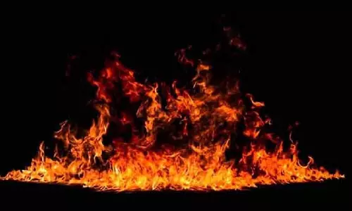 Three men injured in fire at food street in Anna Nagar