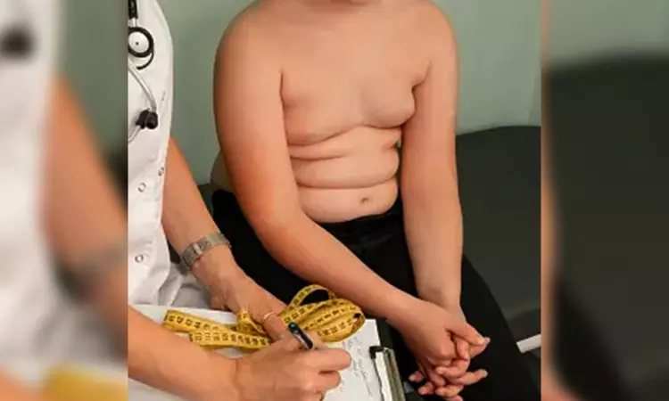 Health experts express concern on rising tide of obesity among Indian kids