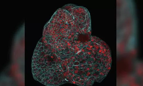 Scientists have used cells from fluid drawn during pregnancy to grow mini lungs and other organs