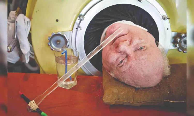 In memoriam: Lawyer, author spent 72 years in an iron lung