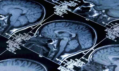 AI can identify clinically anxious youth based on brain structure: Study