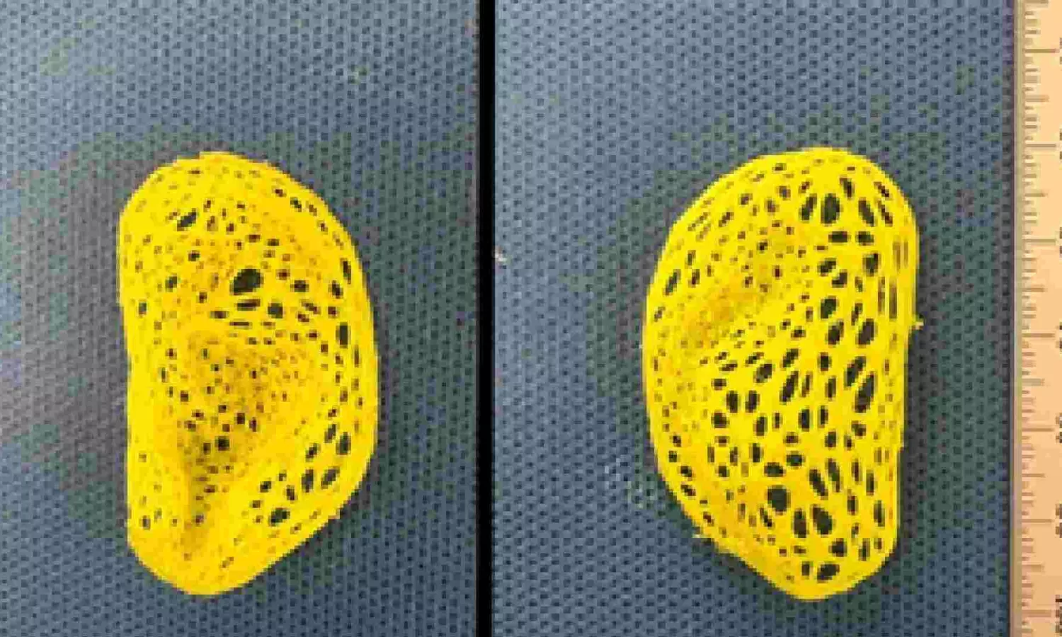 Scientists create replica of an adult human ear that looks & feels natural