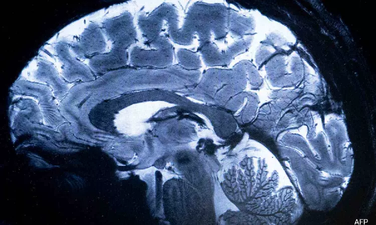 Worlds Most Powerful MRI Scans 1st Images Of Human Brain Worlds Most Powerful MRI Scans 1st Images Of Human Brain