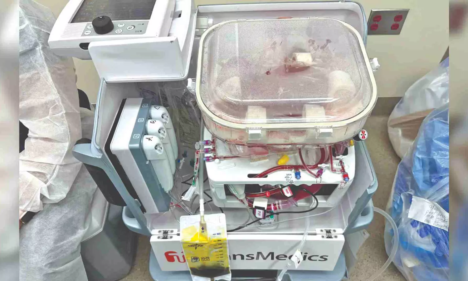 Beating heart, breathing lungs, live liver…all in a box