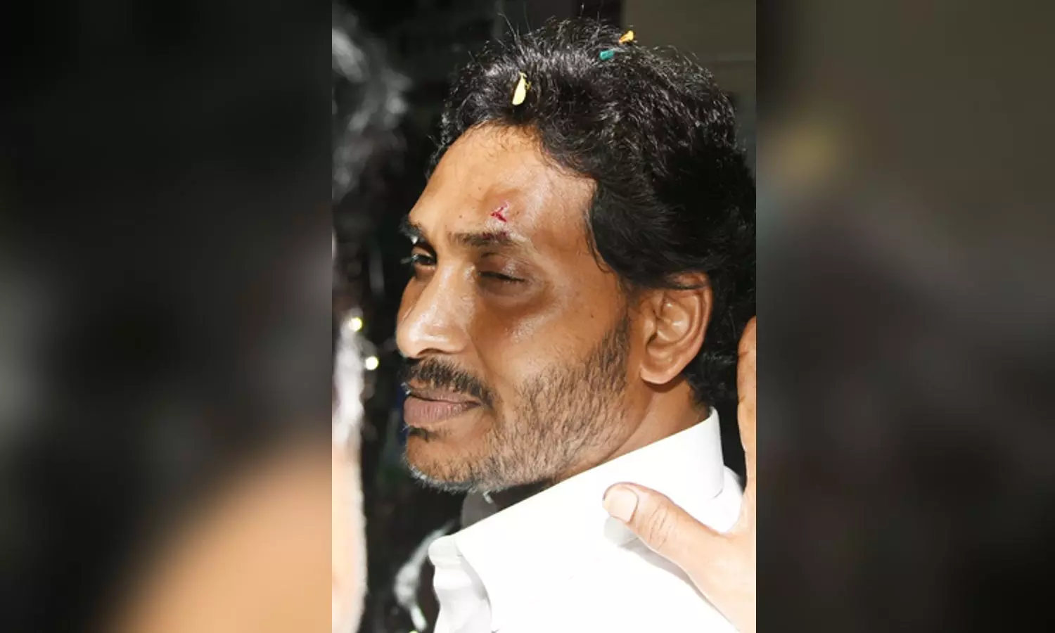 Andhra CM hit by stone during campaigning in Vijayawada