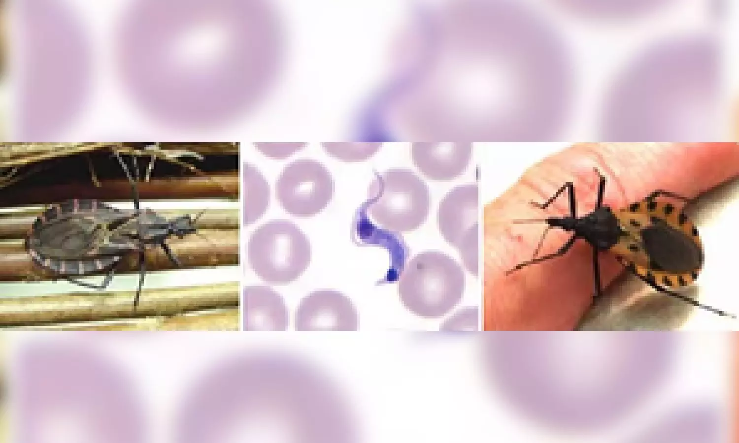 World Chagas Disease Day: WHO calls for early detection for better health