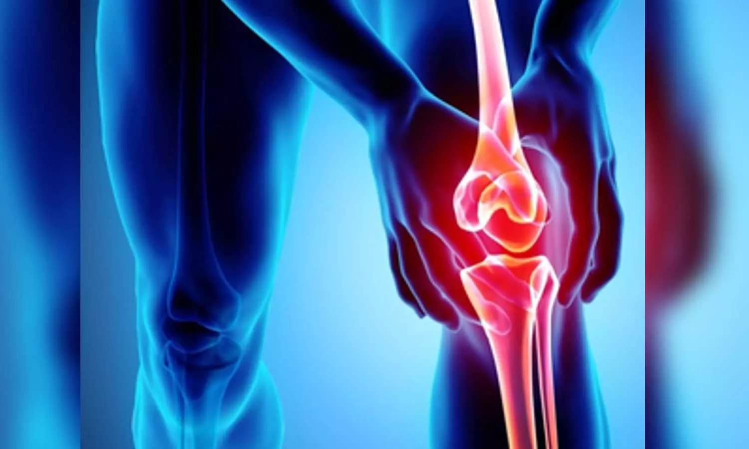 Early detection of osteoarthritis may allow therapy that improves joint health: Researchers
