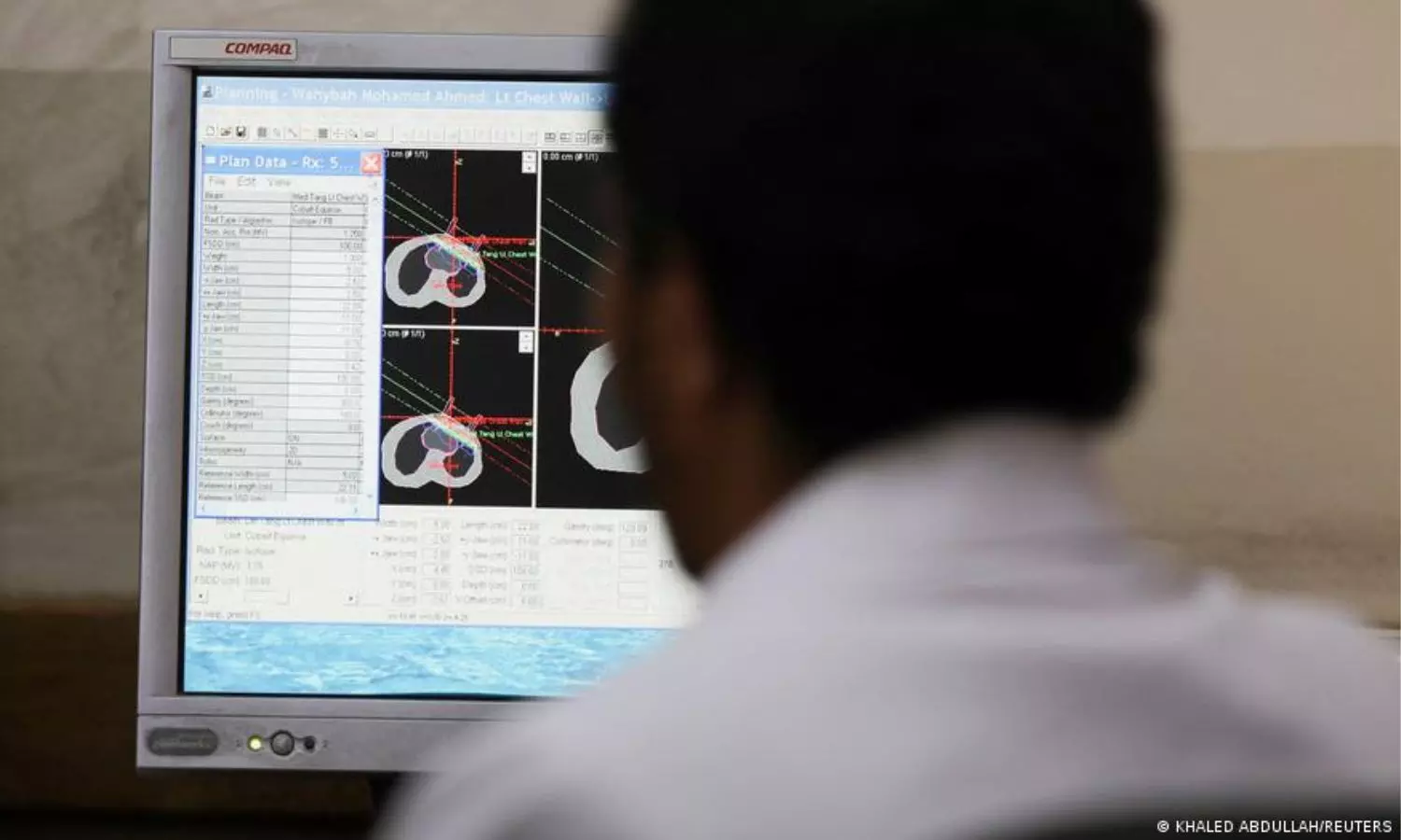 Why are cancer cases soaring in India?