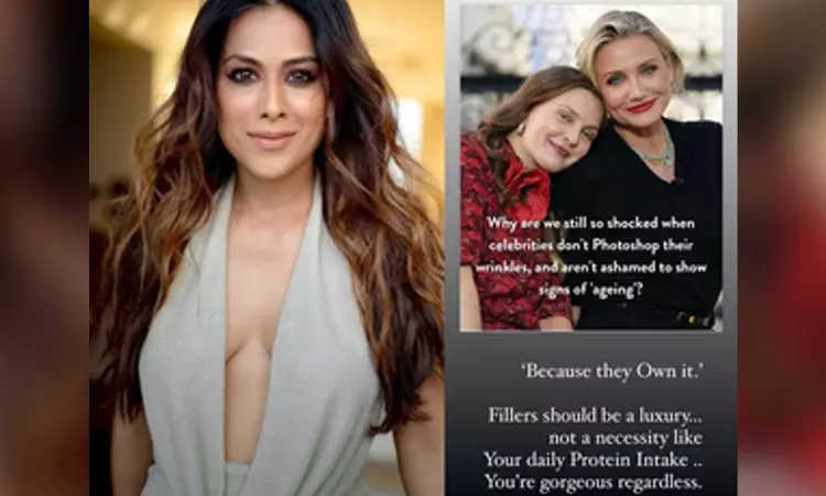 Nia Sharma: Fillers should be a luxury not necessity like your daily protein intake