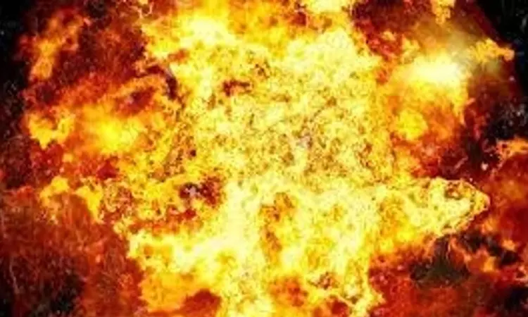 Two children killed in unexploded ordnance blast in Afghanistan Two children killed in unexploded ordnance blast in Afghanistan
