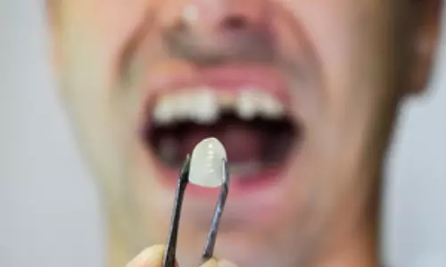 Alcohol-based mouthwash may not be good for your oral health: Study