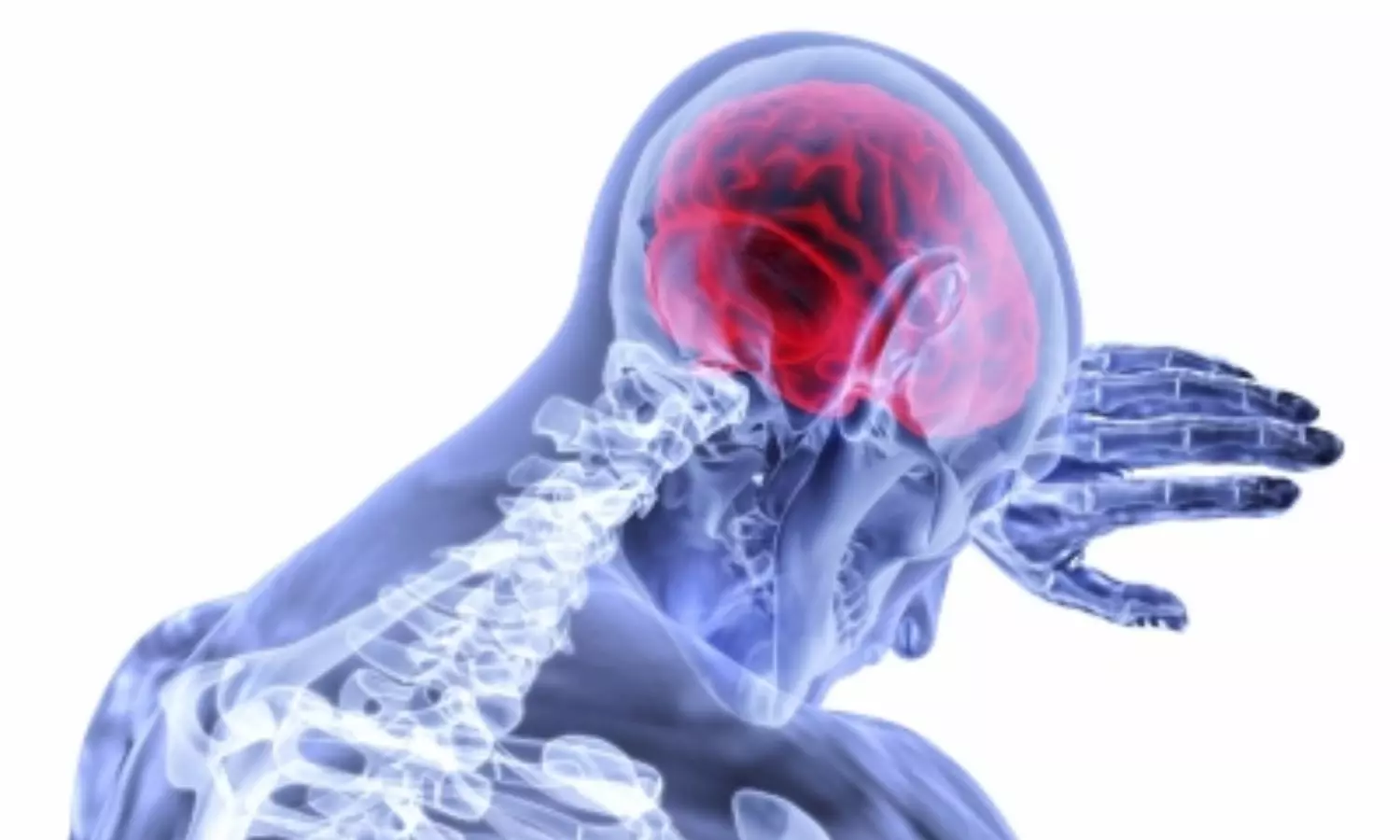Dementia caused by fluid accumulation in brain treatable