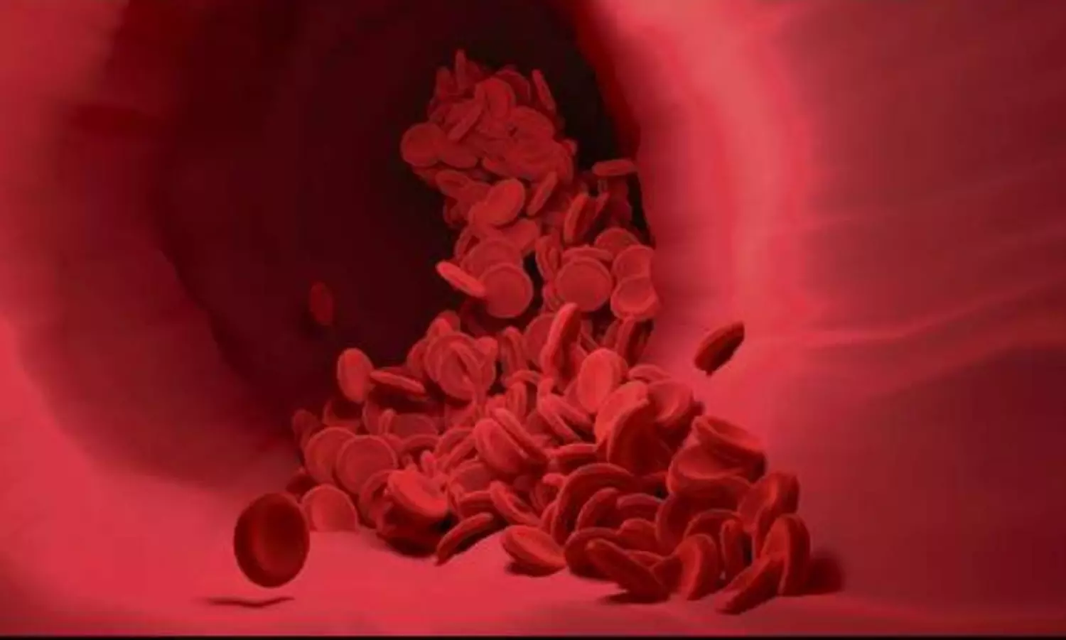 DT health: Chronic Myeloid Leukemia- cancer that affects bone marrow