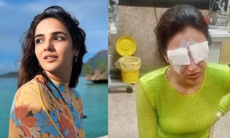 Know what is corneal damage that affected Jasmine Bhasin