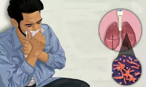 Indian startup to detect TB based on cough sounds with Google’s AI model