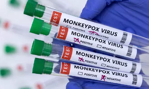 Singapore starts screening incoming passengers for mpox symptoms