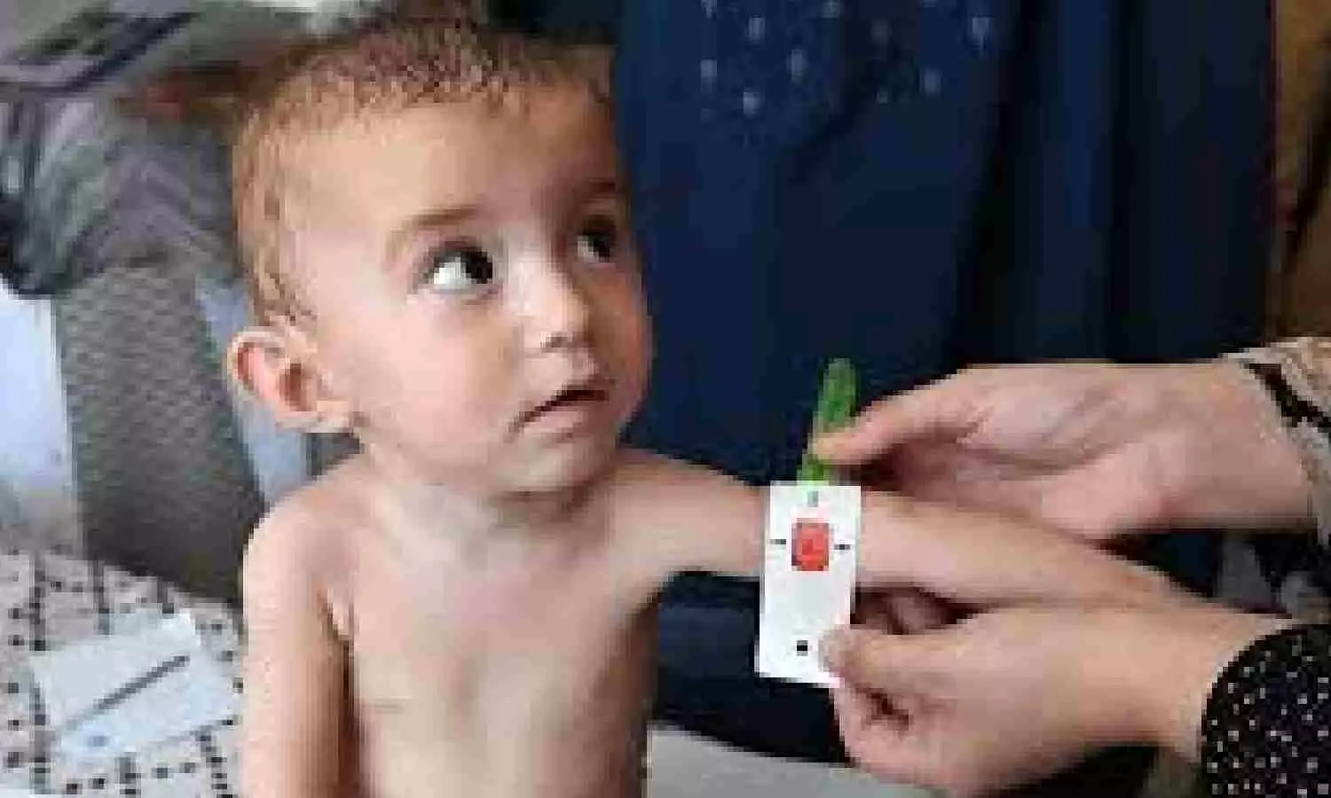 Afghanistan: 26 children die of malnutrition in Badakhshan Afghanistan: 26 children die of malnutrition in Badakhshan