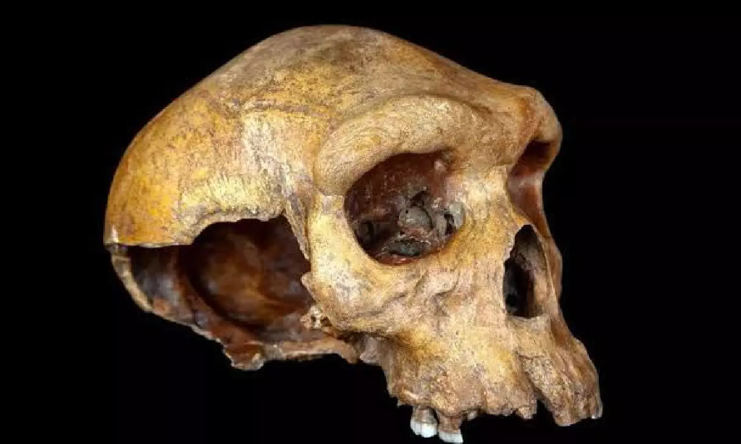 Human skull found at Chennai construction site 9 months after cave-in Human skull found at Chennai construction site 9 months after cave-in