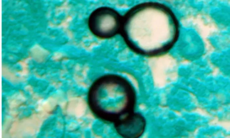 Focussing on bacteria alone will not help combat deadly antimicrobial resistance