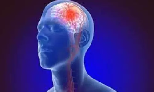 Here’s how silent stroke can dent your brain health Here’s how silent stroke can dent your brain health
