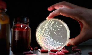 Study links common antibiotic to rise of dangerous superbug Study links common antibiotic to rise of dangerous superbug