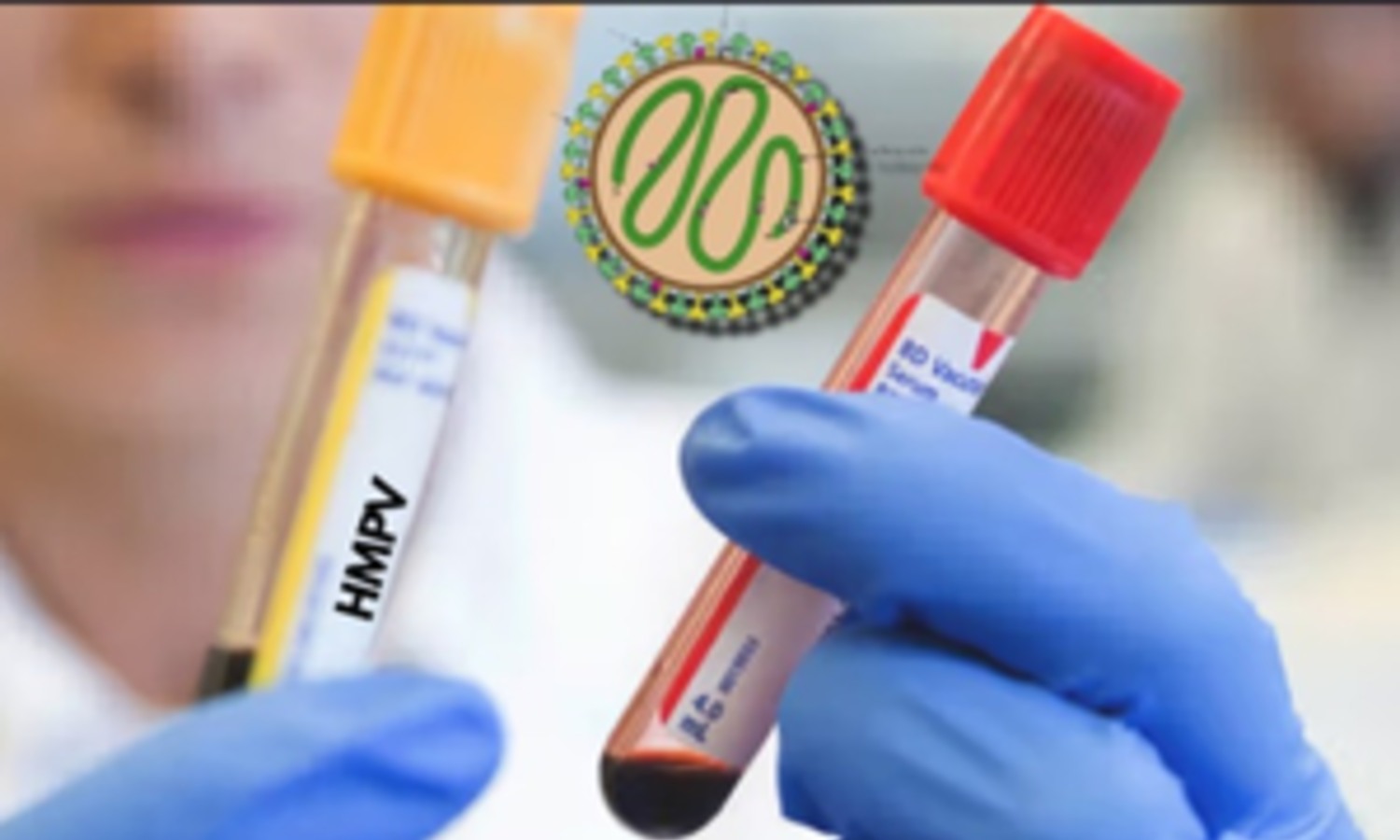 2 children test positive for HMPV in Nagpur, no surge in respiratory illness: Centre 2 children test positive for HMPV in Nagpur, no surge in respiratory illness: Centre