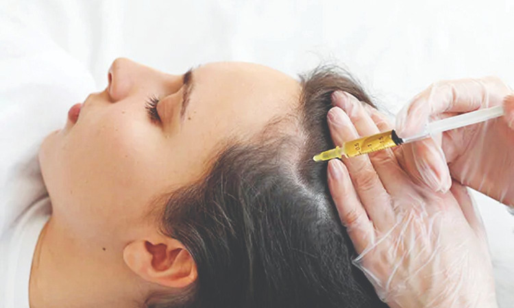 DT Tress Talk: Is PRP treatment for hair loss painful? Understanding the pain and ways to reduce it DT Tress Talk: Is PRP treatment for hair loss painful? Understanding the pain and ways to reduce it