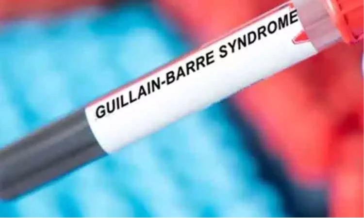 Bengal reports another Guillain-Barre fatality, official toll rises to two Bengal reports another Guillain-Barre fatality, official toll rises to two