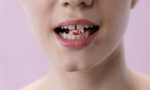 SE Asia carries highest global burden of oral diseases, mouth cancers: WHO