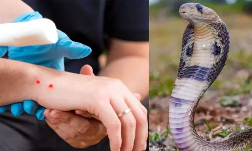 DT Next Health: Highest number of snakebite deaths recorded in India