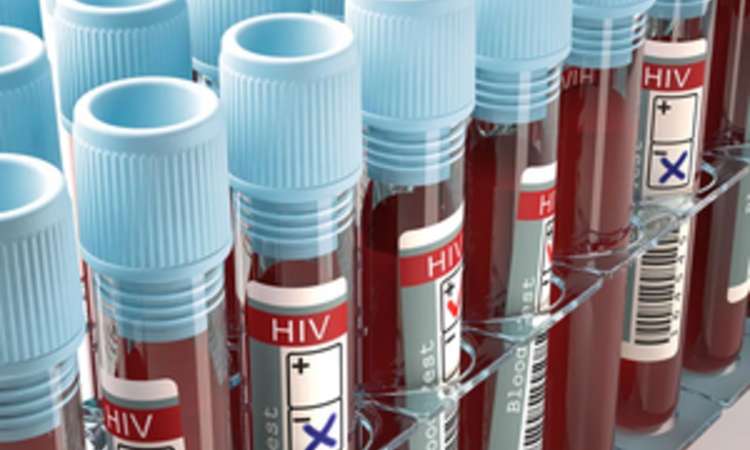 Cutting HIV aid, Nigeria shows the human costs