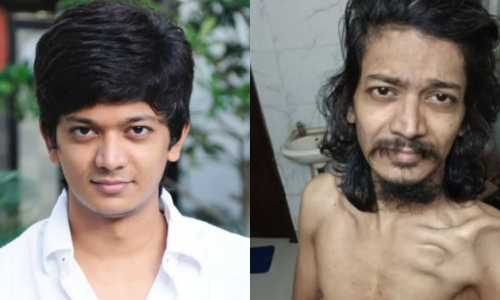 Actor Shri under expert medical care, says family