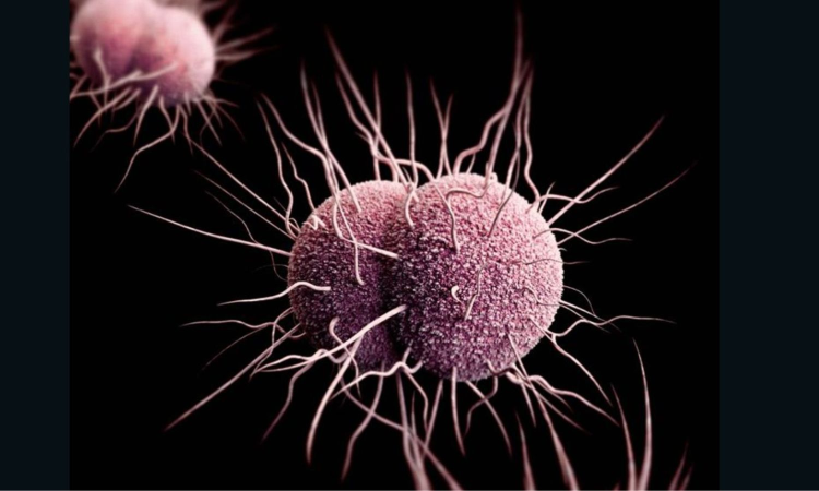 New oral pill offers hope against antibiotic-resistant gonorrhoea