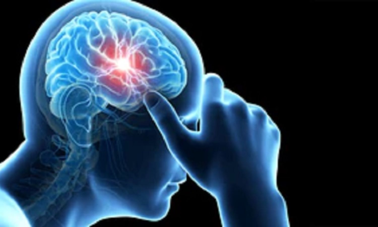 Study finds common genetic variants linked to drug-resistant epilepsy Study finds common genetic variants linked to drug-resistant epilepsy