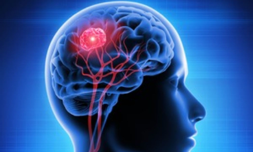 Key enzyme to fight deadly brain cancer identified