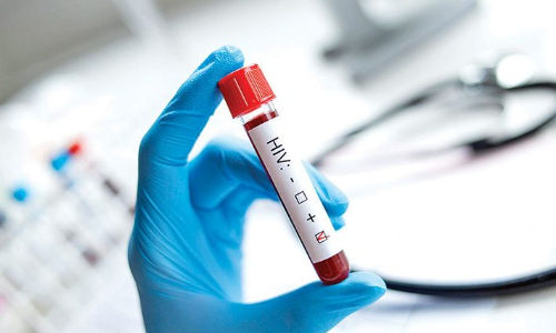 Study shows HIV prevalence rising in older adults, but prevention focusses youth