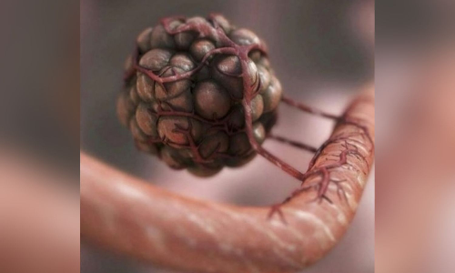 Researchers find genetic fingerprints to predict efficacy of immunotherapy