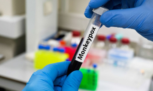 Africa CDC urges aggressive action to curb mpox outbreak in southern Ethiopia