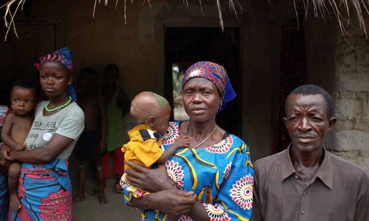 Shifting Focus: Starvation easy-fix problem; really?