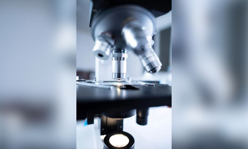 New way of measuring blood pressure could be a lifeline for thousands of people