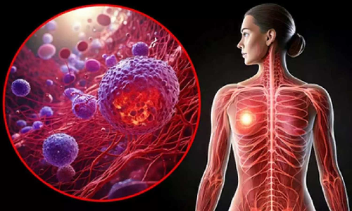 Covid and flu viruses can wake up breast cancer cells spread in lungs: Study