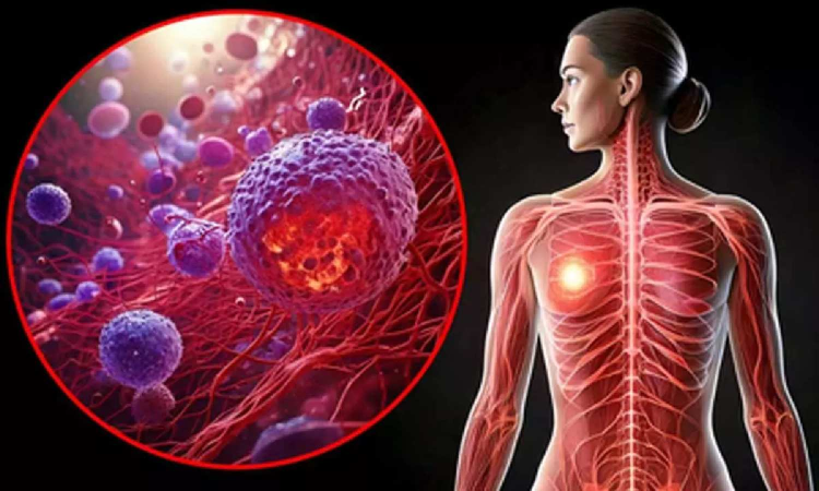 Covid and flu viruses can wake up breast cancer cells spread in lungs: Study