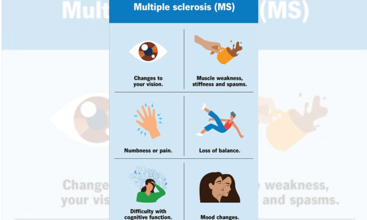 Multiple sclerosis may emerge a decade before neurological symptoms begin to appear