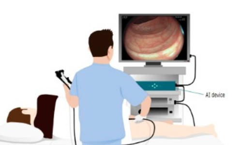 AI-assisted colonoscopies may raise deskilling risk among doctors: The Lancet