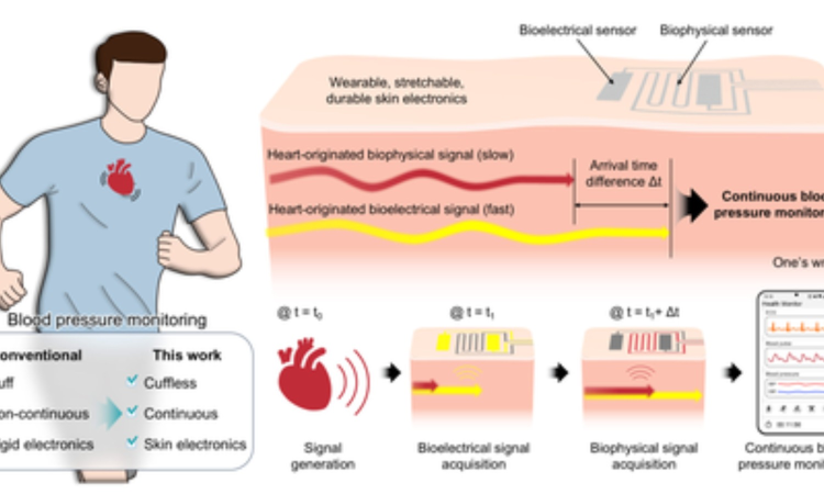 New bandage-like wearable monitor to enable continuous measurement of BP