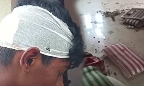 Chidambaram: Lightning strike injures schoolboy, damages household appliances