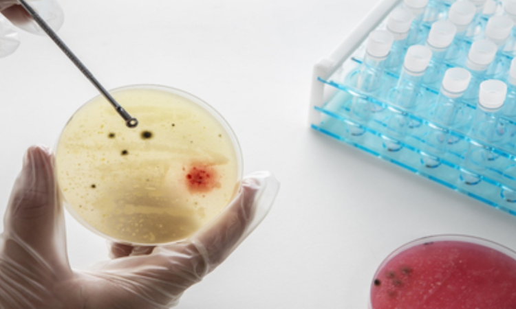 IIT Bombay study shows how TB bacteria shield themselves from antibiotics, stay alive longer