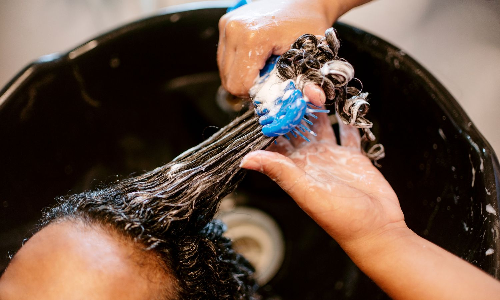 DT Tress talk| Can dandruff be treated at home without consulting a doctor? DT Tress talk| Can dandruff be treated at home without consulting a doctor?